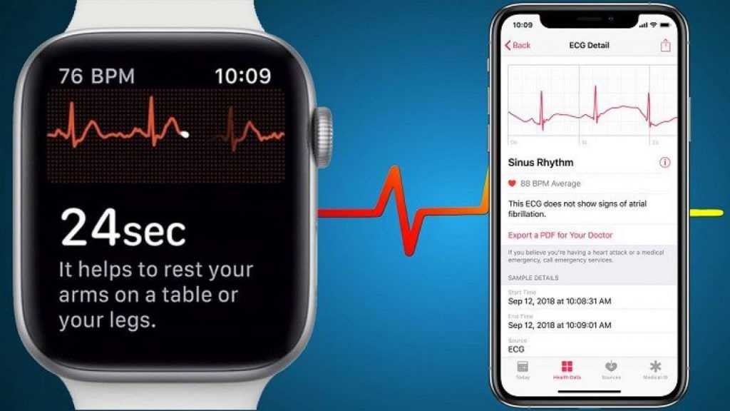 Apple Watch EKG uygulaması nasıl kullanılır